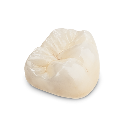 Full Contour Zirconia